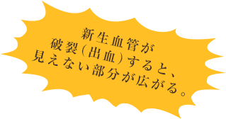 新生血管が破裂（出血）すると、見えない部分が広がる。